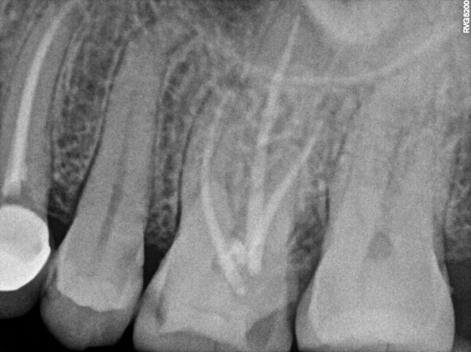 Dental X-ray